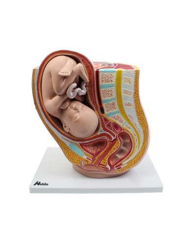 Dubens, nėštumo metu, modelis