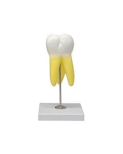 Viršutinio krūminio danties modelis, trijų šaknų