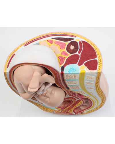 Dubens, nėštumo metu, modelis