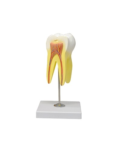 Viršutinio krūminio danties modelis, trijų šaknų