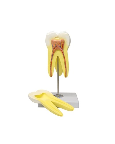 Viršutinio krūminio danties modelis, trijų šaknų
