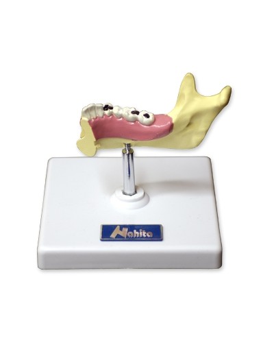 Apatinio žandikaulio dalies modelis